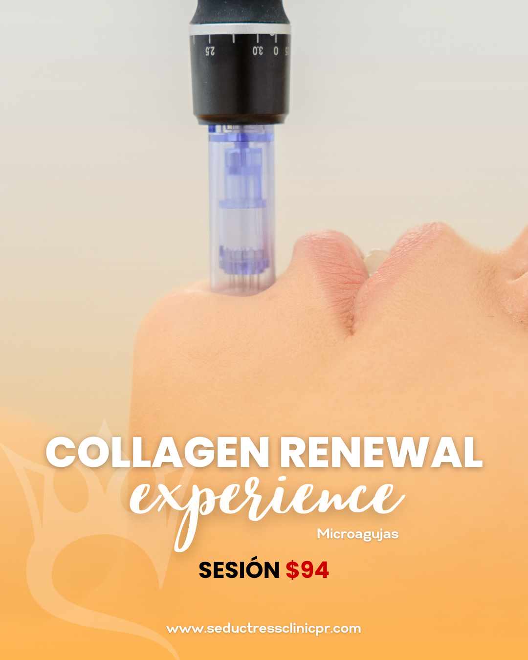 Collagen Renewal Experience (Microagujas)