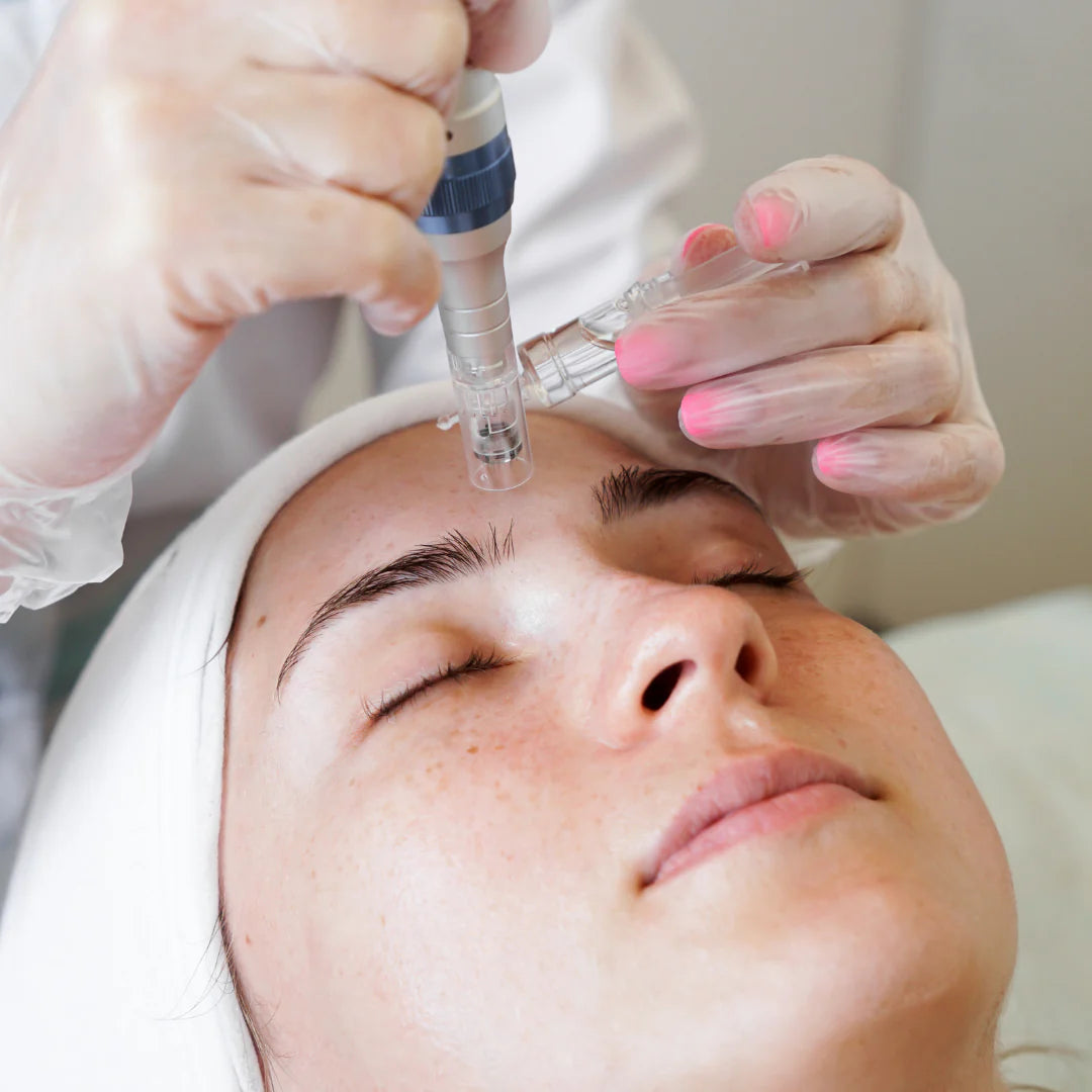LUXE FIRM & GLOW: EL PODER DEL MÉTODO REJUVENENSSE + MICROAGUJAS