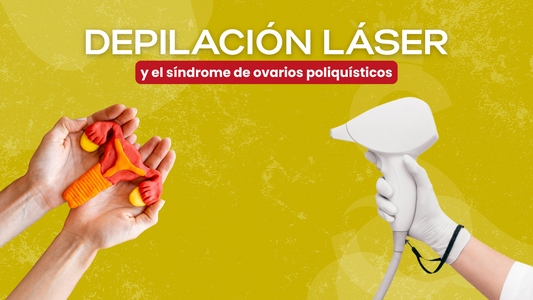 Depilación Láser en Mujeres con SOP: Lo Que Debes Saber