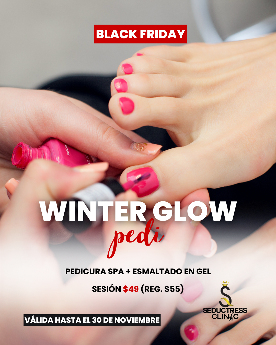 Winter Glow Pedi