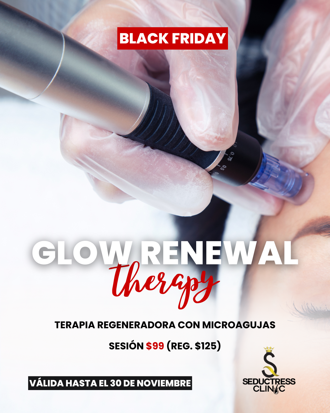 Glow Renewal Therapy