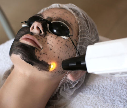 Hollywood Laser Carbon Peel